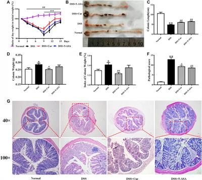 Curcumin Regulated the Homeostasis of Memory T Cell and Ameliorated Dextran Sulfate Sodium-Induced Experimental Colitis